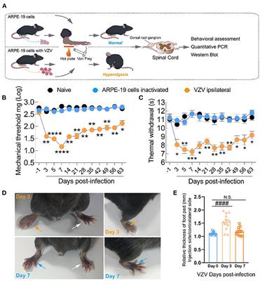 Change in Cav3.2 T-Type Calcium Channel Induced by Varicella-Zoster Virus Participates in the Maintenance of Herpetic Neuralgia